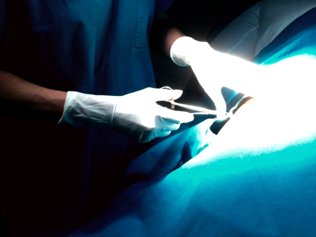 Radiotalasna hirurgija