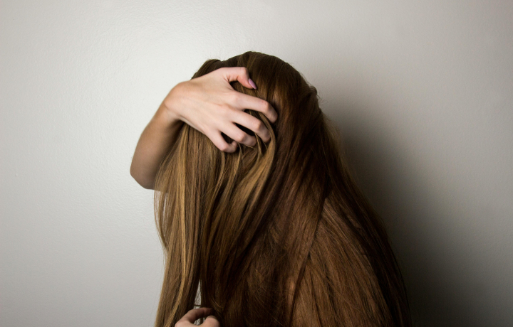 A HATÁSOS TERÁPIA MEGVÁLASZTÁSA ANDROGÉN ALOPECIA ESETÉN